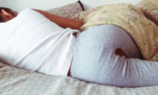 Dette mensenbildet ble for ekstremt for Instagram