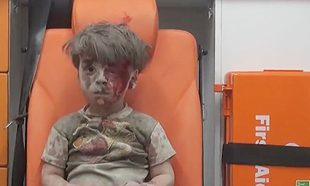 Videoen av Omran (5) spres verden over: - Aleppos barn har vært under angrep i fire år