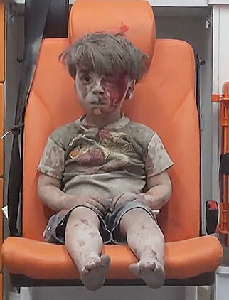 Omran (3) var i huset med mor, far og tre søsken da bombene falt. I natt ble storebroren operert