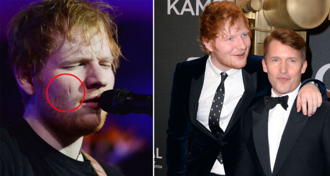 Ed Sheeran vekket oppsikt med kongelig sverdulykke. Nå avslører kompisen sannheten