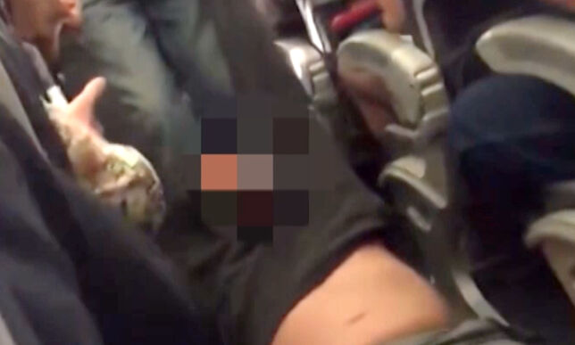 United Airlines-passasjer brakk nesen og pådro seg hjernerystelse
